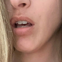 emma-skyeefree Meztelen