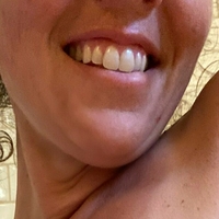 sneakinsalliefree Meztelen