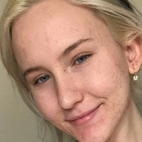 Trippi Miki Meztelen