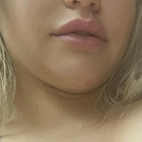 Your Neko Baby Meztelen